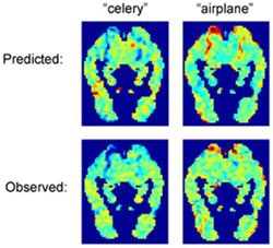 Pagal smegenų MRI galima nustatyti, apie kokį žodį galvoja žmogus