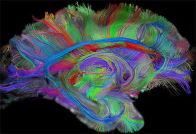 Naujoji vaizdų apdorojimo sistema leidžia pamatyti jungtis tarp atskirų smegenų sričių