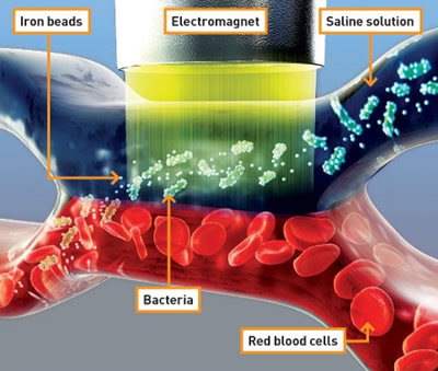 Naujas metodas leidžia pašalinti bakterijas iš kraujo su elektromagnetu
