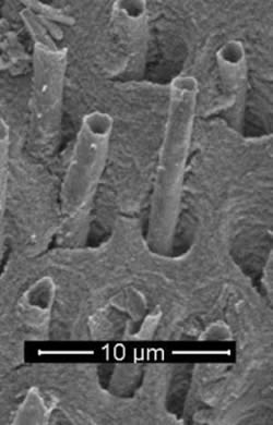 Elektroninio mikroskopo nuotraukoje gerai matyti  kirminų pavidalo struktūros, „augančios“ iš giliai dantyje esančių porų.