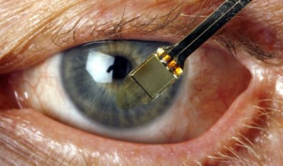 Tinklainės implantai grąžino regėjimą akliesiems