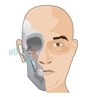 „SoundBite“ veikimo principas