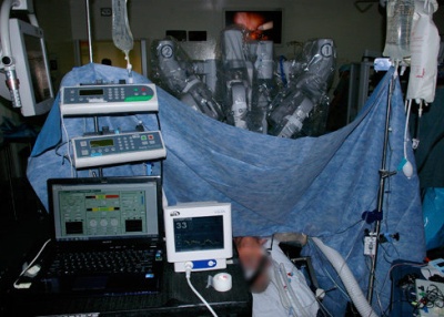 Kanadoje atlikta pirmoji pasaulyje visiškai robotizuota chirurginė operacija