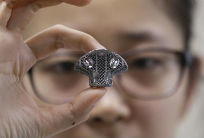 Vaikui implantavo stuburo slankstelį, sukurtą su 3D spausdintuvu