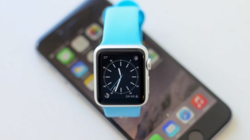 „Apple Watch“ apžvalga: noriu, bet ar tikrai reikia?