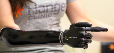 „Touch Bionics“ pristatė išmanųjį protezą „I-limb Quantum“ „Touch Bionics“ pristatė išmanųjį protezą „I-limb Quantum“