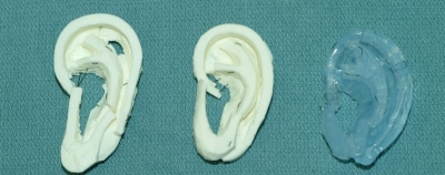 Naujos 3D spausdinimo technologijos jau taikomos kuriant ausies implantus