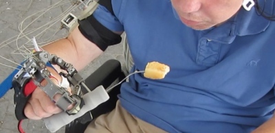 Sukurta robotinė ranka, skirta sergantiems tetraplegija