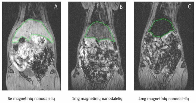 Magnetinės nanodalelės medicinoje