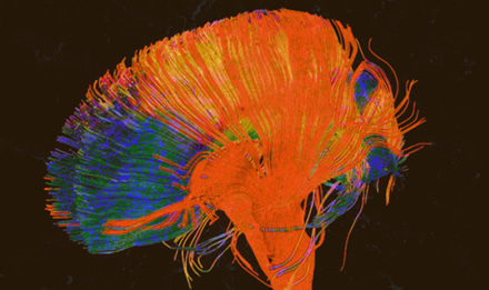 Inžinierių komanda iš Kalifornijos išaugino nemirtingas sintetines smegenis