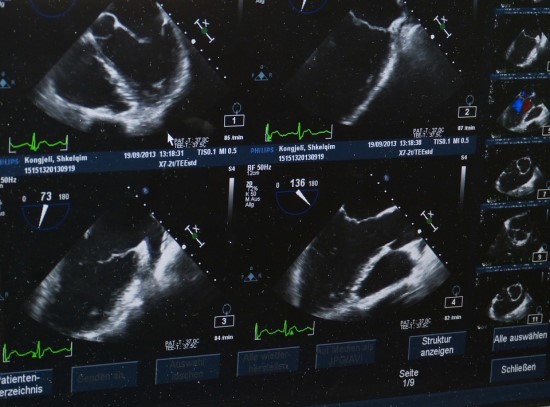 Radiologai paneigė mitus apie ultragarsinį tyrimą: kada jis atliekamas ir ką gali parodyti?