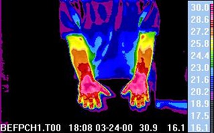 Žmogaus kūnas išskiria nemažai šilumos, kurią galima paversti elektra  © thermology.com