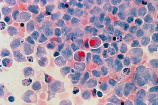 Asociatyvi nuotrauka Asociatyvi nuotrauka