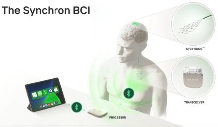 „Synchron Stentrode“