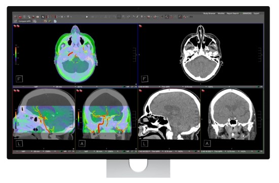 „Apple“ pristatė naują „Studio Display“ ir visiškai naują „Studio Display XDR“