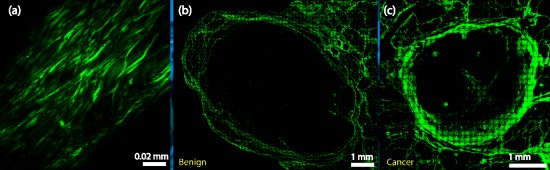 Pav. 1. Piktybinio ir gerybinio naviko kapsulių pavyzdžiai